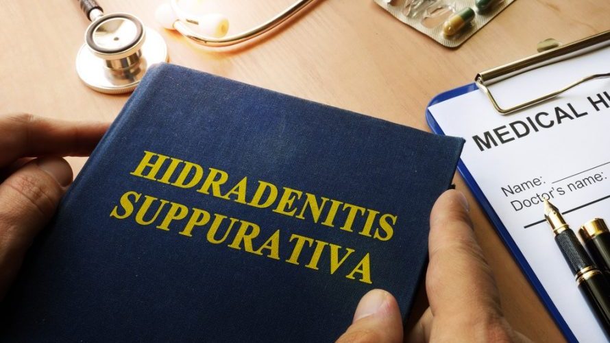 The Truth About the Best Hidradenitis Suppurativa Natural Treatment