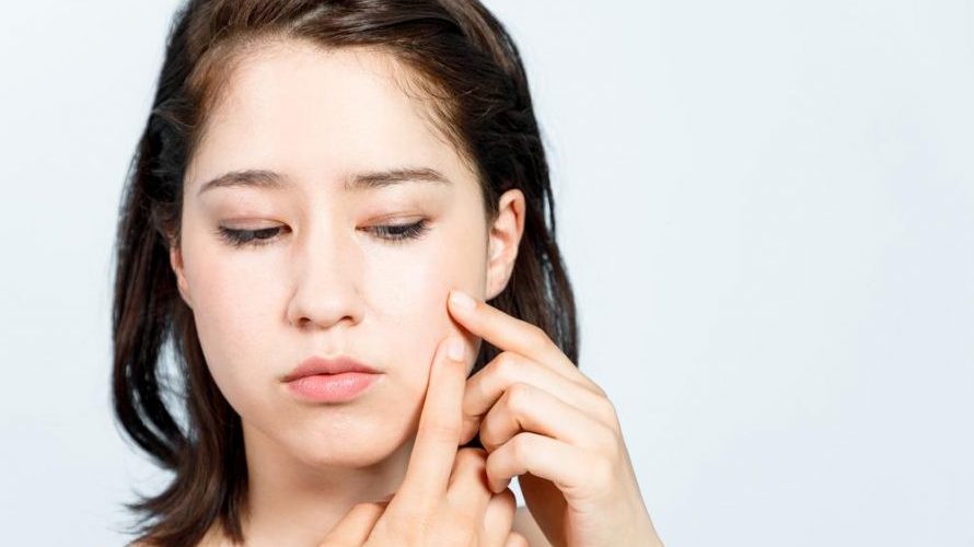 Will Blackheads Go Away Without Squeezing?