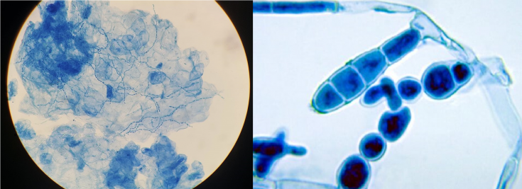 dermatophytes under microscope