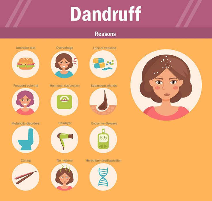 causes of dandruff