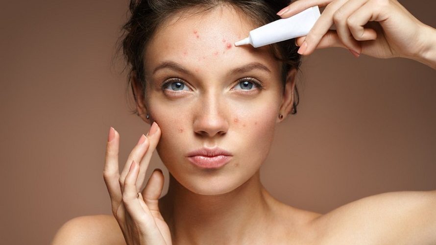 How To Get Rid Of Blackheads On Forehead?
